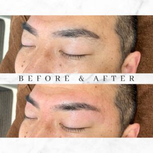 眉毛ワックス脱毛－before-after