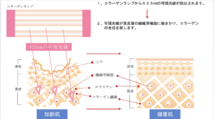 コラーゲンマシン効果